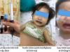 1 giờ sau khi ăn canh nấu bằng nước giếng, bé gái tím tái toàn thân, máu chuyển thành màu đen